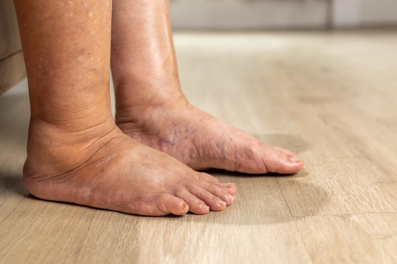 VOXX-SPORTOVNI-PONOZKA